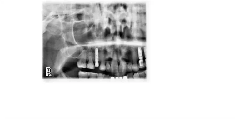 Horizontal and vertical segmenting