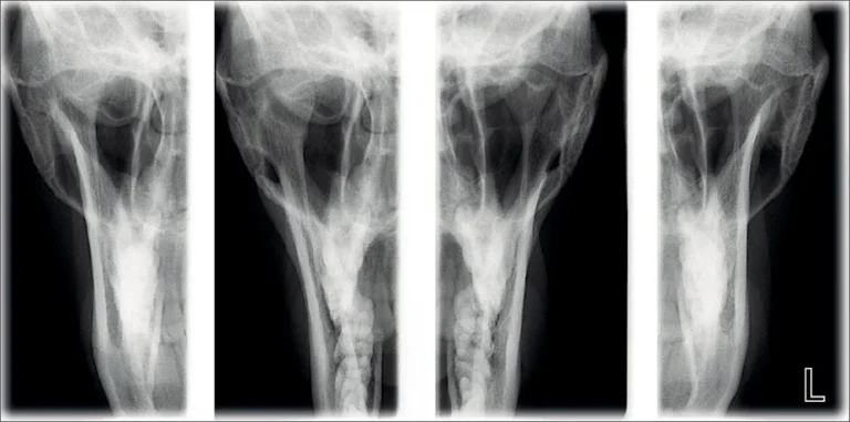 PA TMJ (closed & open)