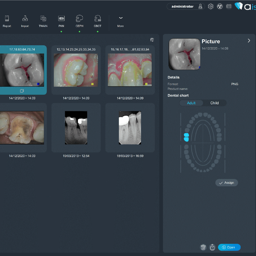 acteon imaging suite